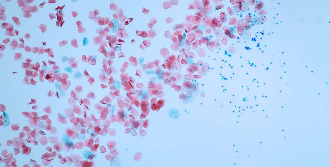 无纺布不是布? 环保袋也是塑料制成的? 第8张 无纺布不是布? 环保袋也是塑料制成的? 第8张